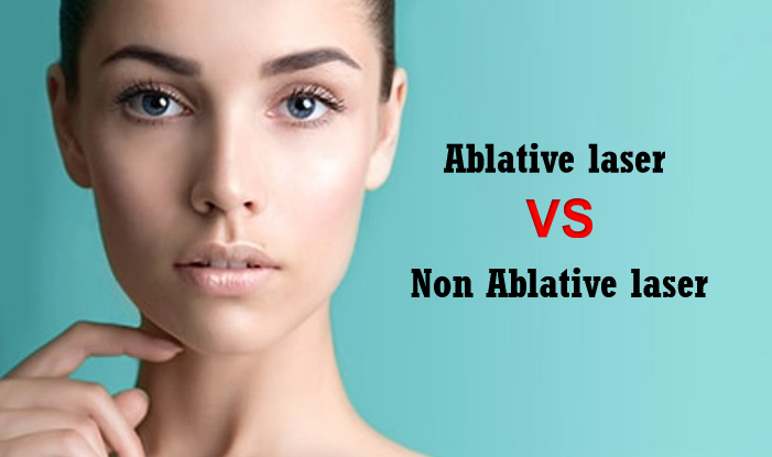 Quelle est la différence sur le laser ablatif et non ablatif?