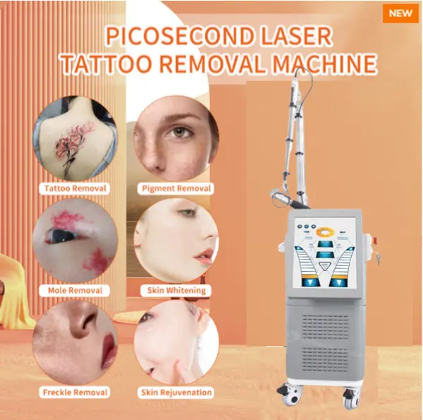 Laser Picosencond --- Comment enlever efficacement les tatouages ​​?
