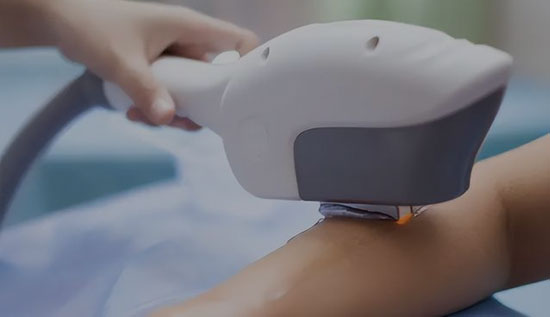 Machine laser IPL