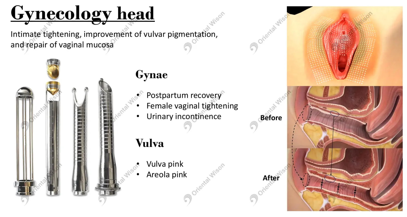 Spiral Co2 Laser Skin Resurfacing Machine
